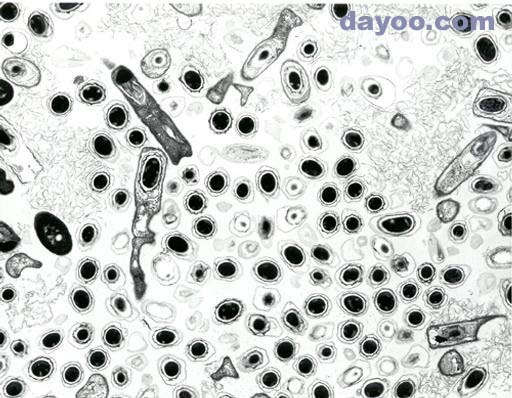 炭疽芽孢杆菌油镜图片图片