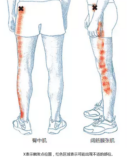 臀部和大腿的肌肉紧绷,缩短,造成筋膜紧绷,导致筋膜与膝盖外侧摩 